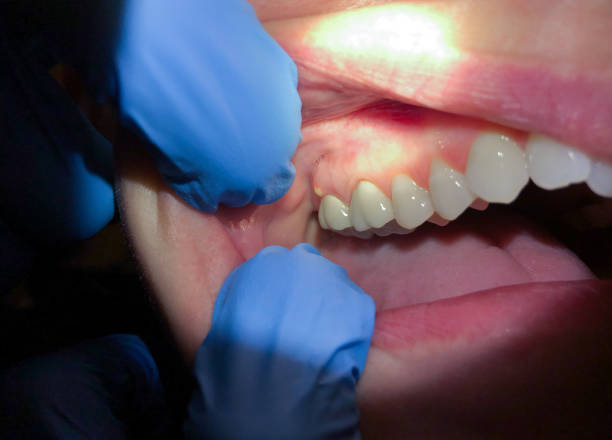 Best Dentist for Dental Trauma  in USA